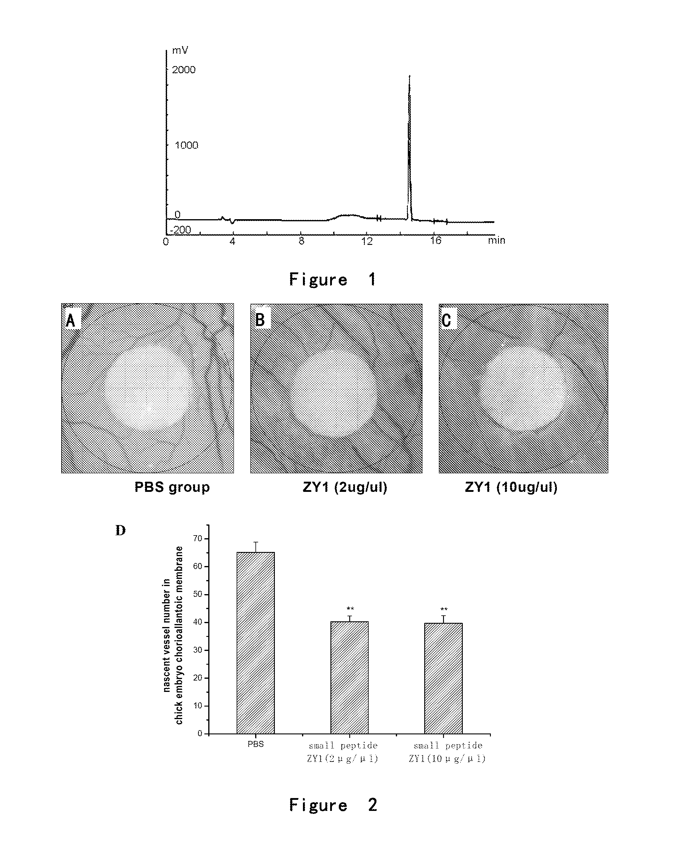 Angiogenesis-inhibiting peptide and application thereof