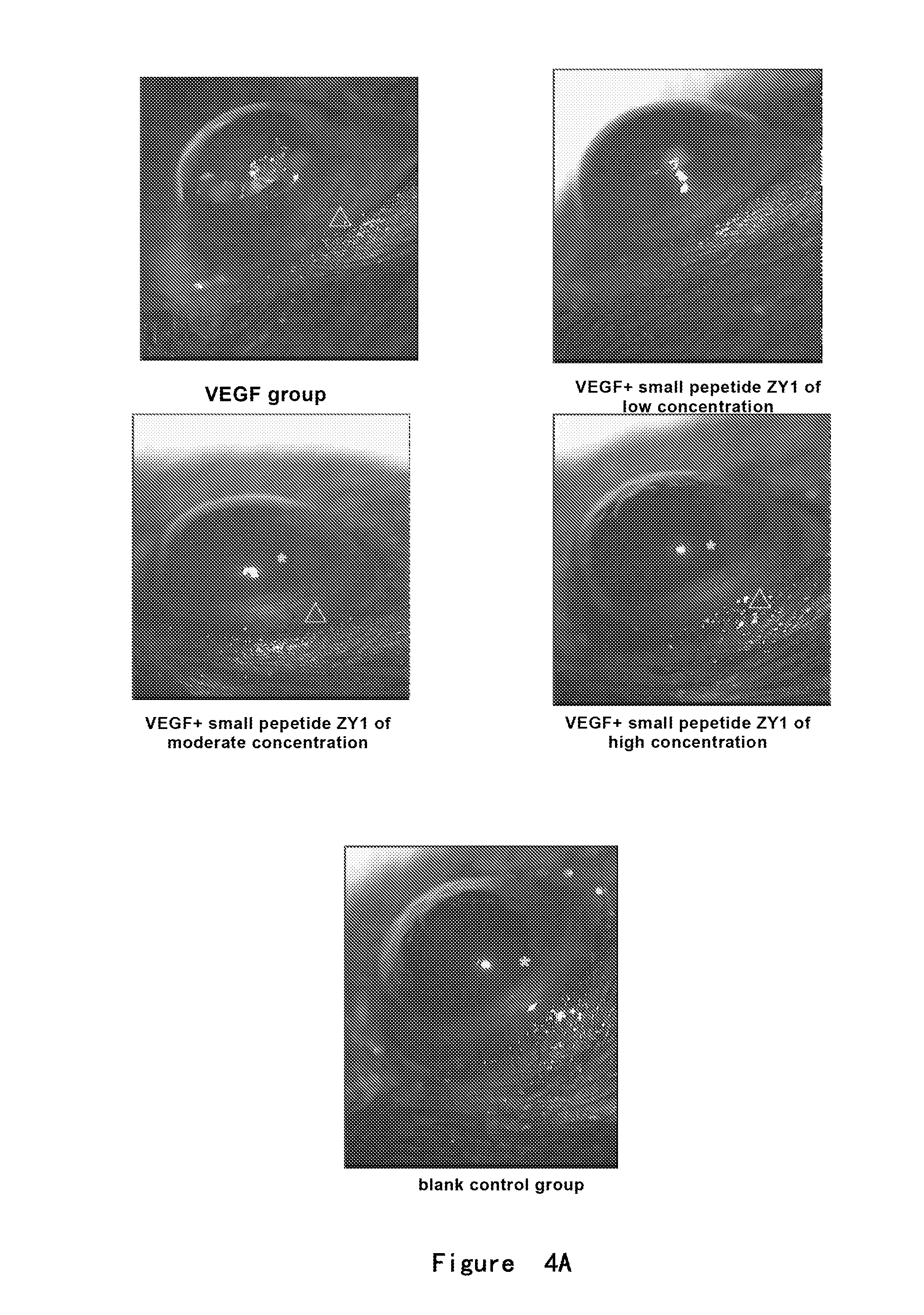 Angiogenesis-inhibiting peptide and application thereof