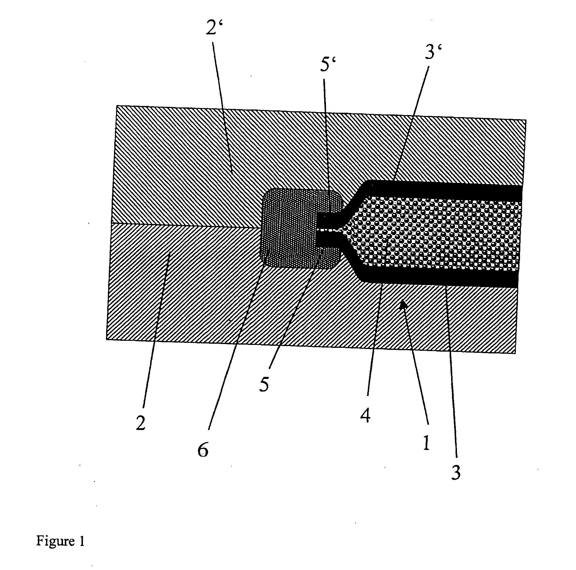 Composite component