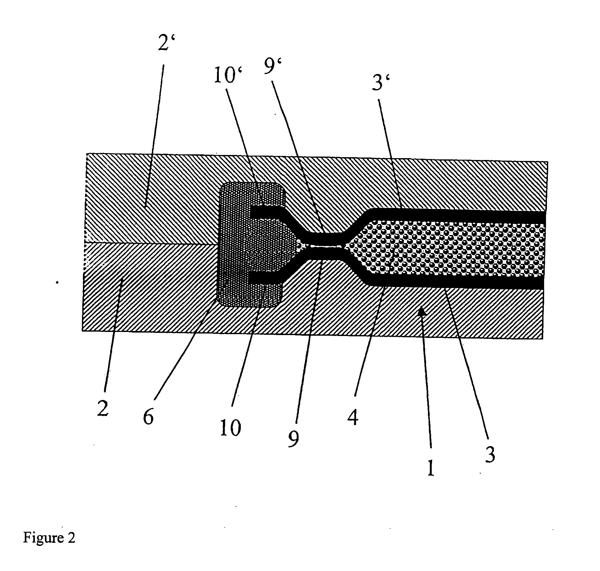 Composite component