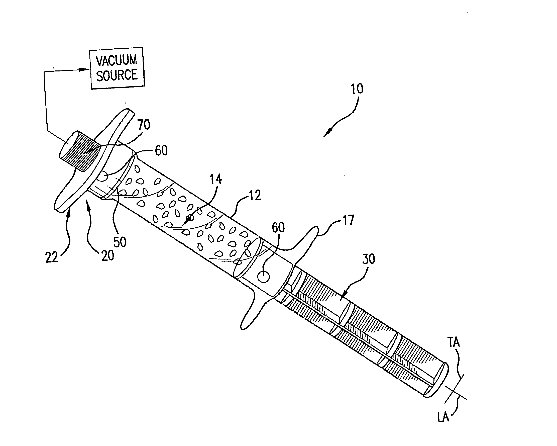 Perfusion Device and Method