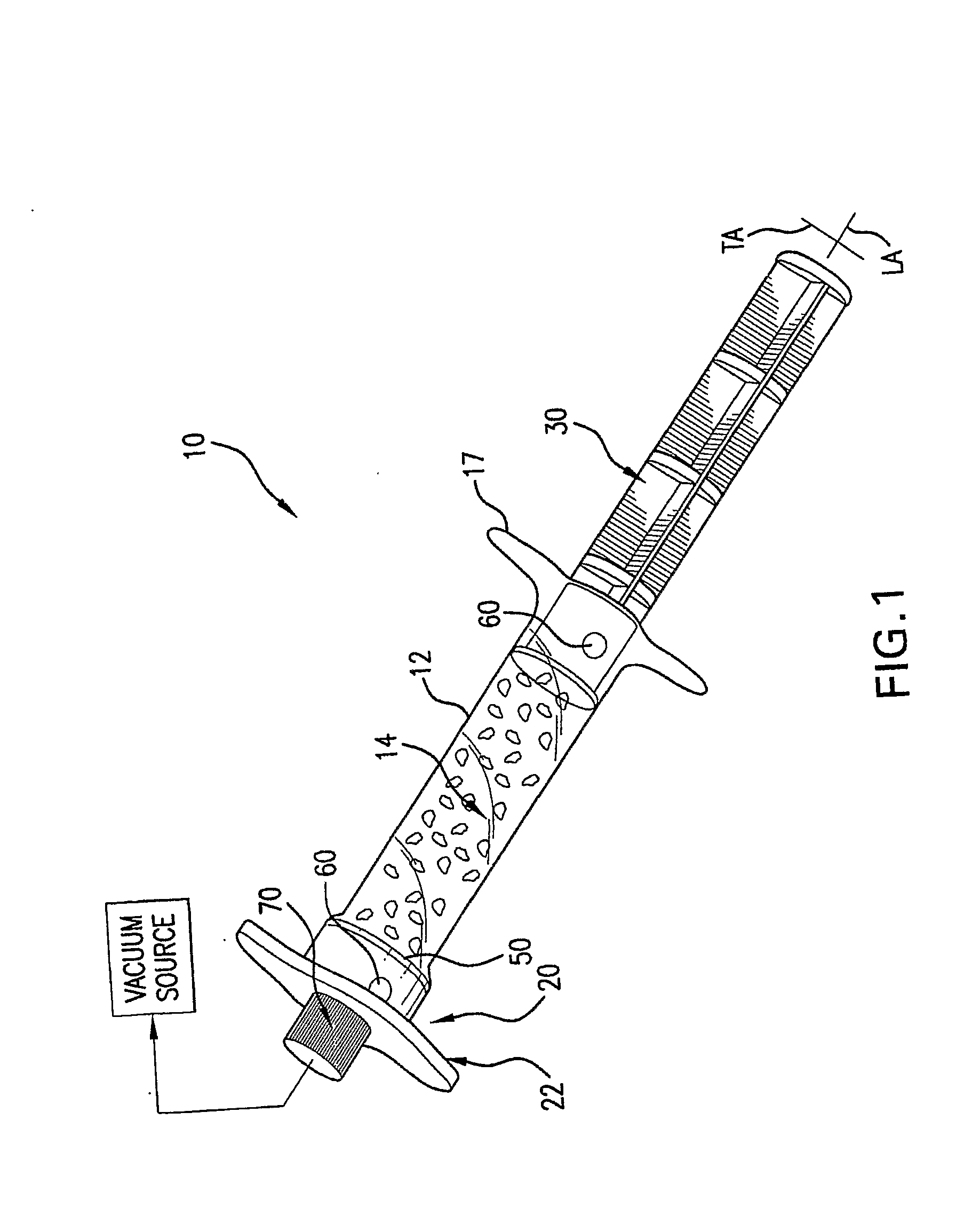 Perfusion Device and Method