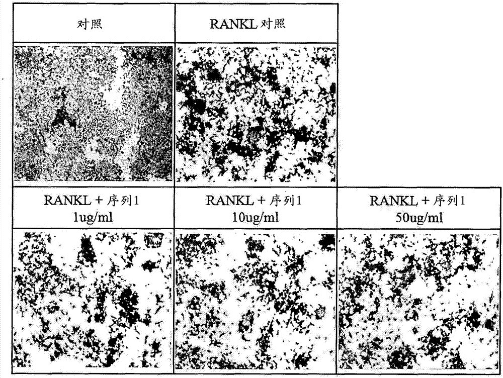 Peptide having osteoclast differentiation and activation inhibition, and use of same