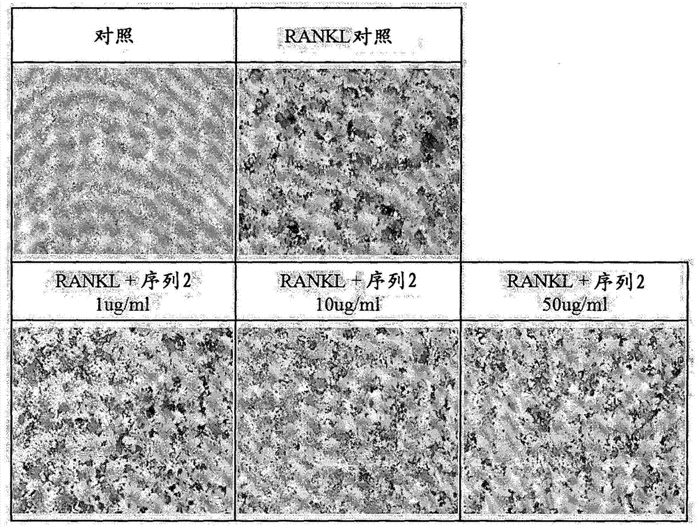 Peptide having osteoclast differentiation and activation inhibition, and use of same