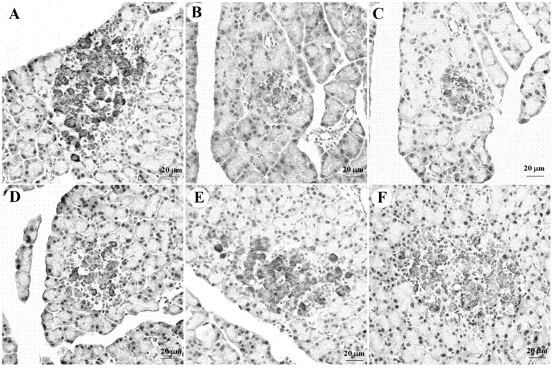 Preparation method for mulberry leaf polysaccharide hypoglycemic active component