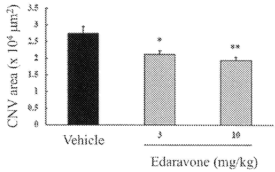 Agent for preventing and/or treating ophthalmologic diseases