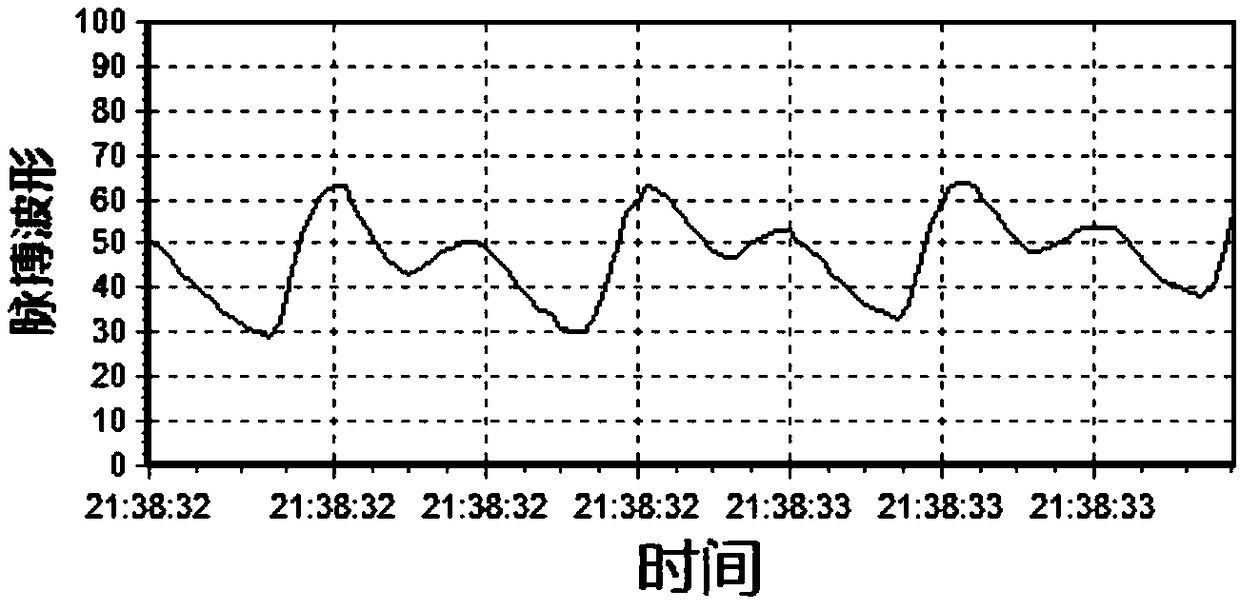 Intelligent mouse system with physiological parameter monitoring and early warning functions and working method thereof, and monitoring and early warning system