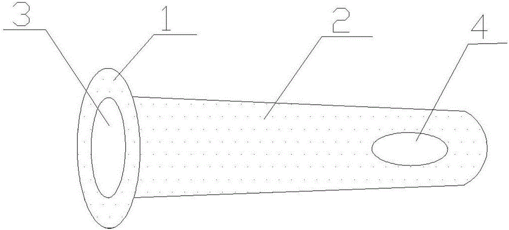 Rectal prolapse trigger point injection anoscope