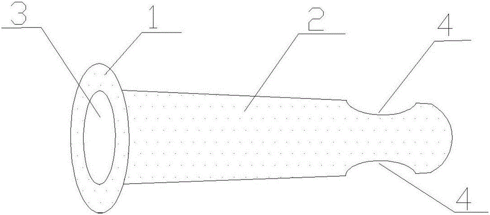 Rectal prolapse trigger point injection anoscope