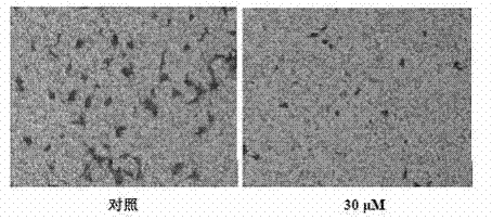 Application of dehydrocostuslactone to preparing drug for inhibiting angiogenesis