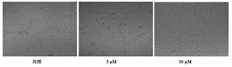 Application of dehydrocostuslactone to preparing drug for inhibiting angiogenesis