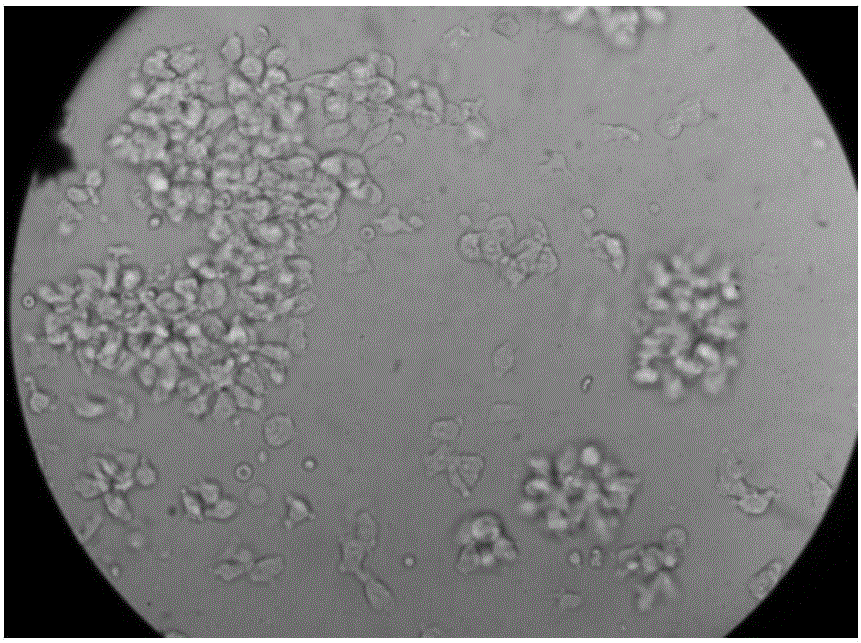 In-vitro culture kit for EBV-CTL