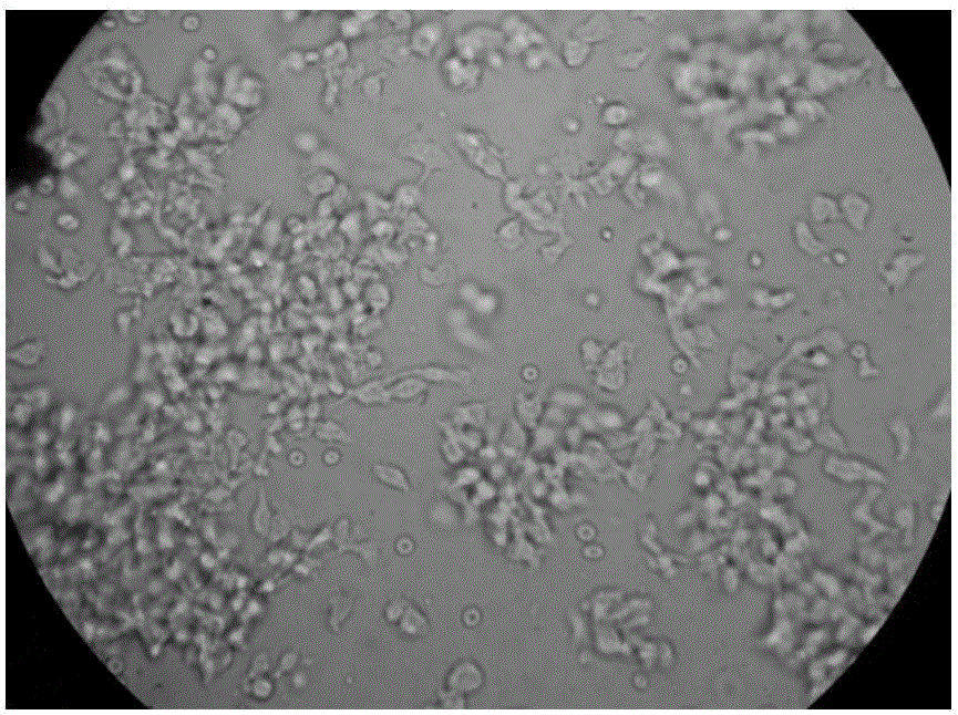 In-vitro culture kit for EBV-CTL