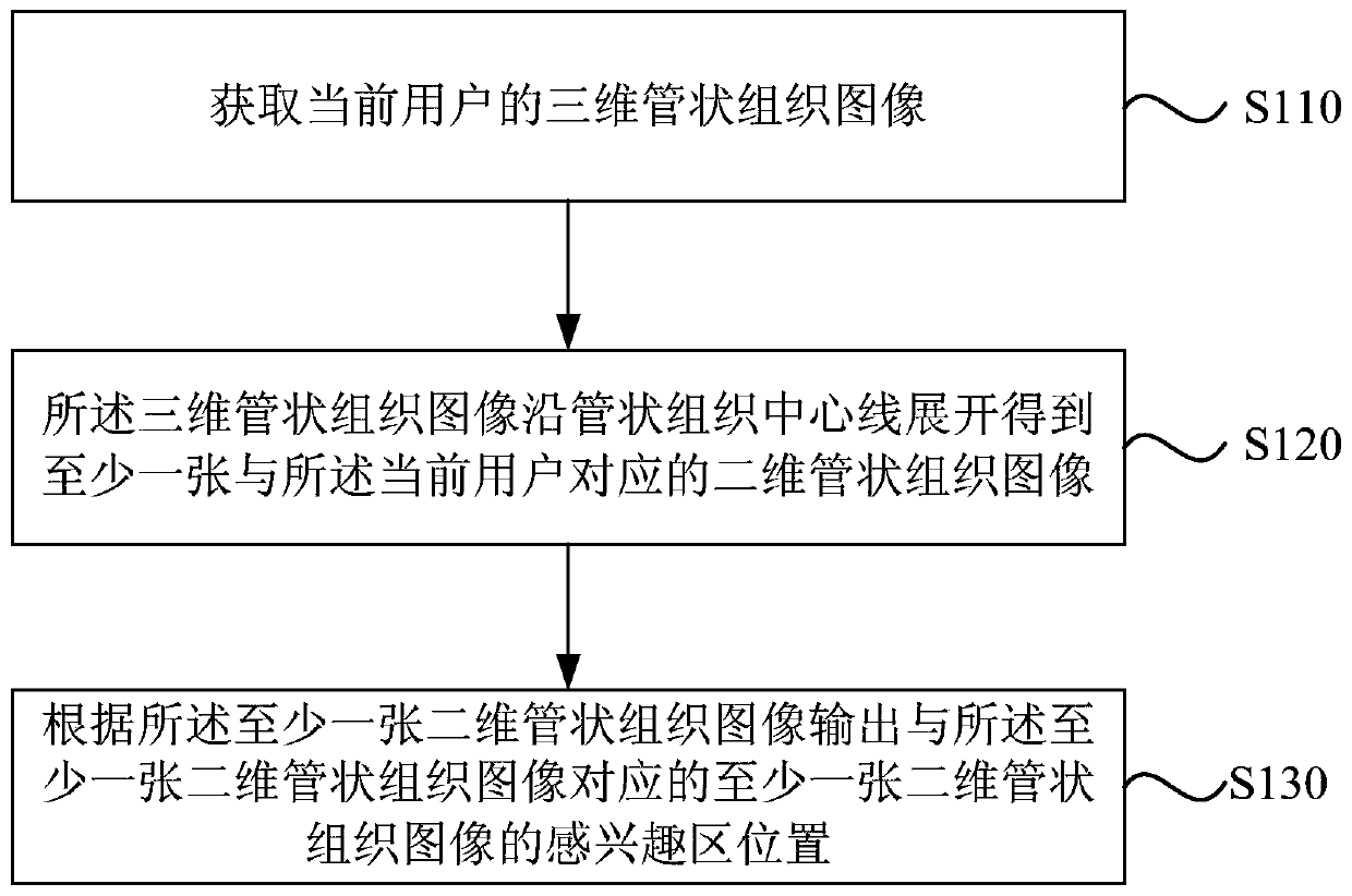 Method and device for determining tubular tissue region of interest, equipment and medium