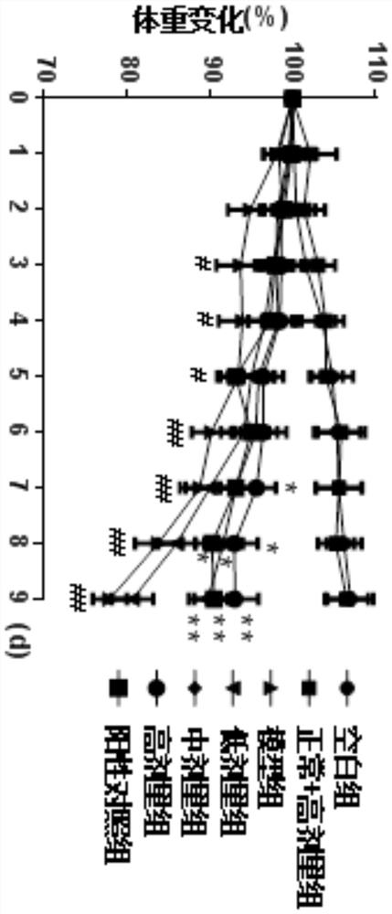 Composition for treating or preventing inflammatory bowel diseases, preparation method, preparation and application thereof