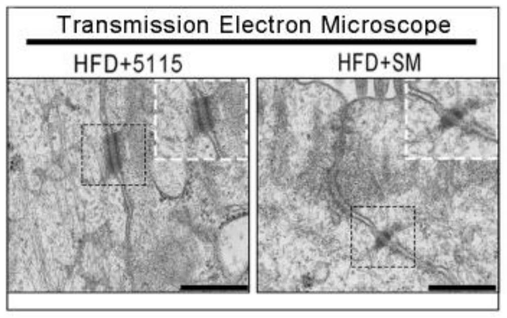 Lactobacillus paracasei fermented milk (powder), preparation method thereof and application of lactobacillus paracasei fermented milk (powder) in elimination of intestinal barrier damage