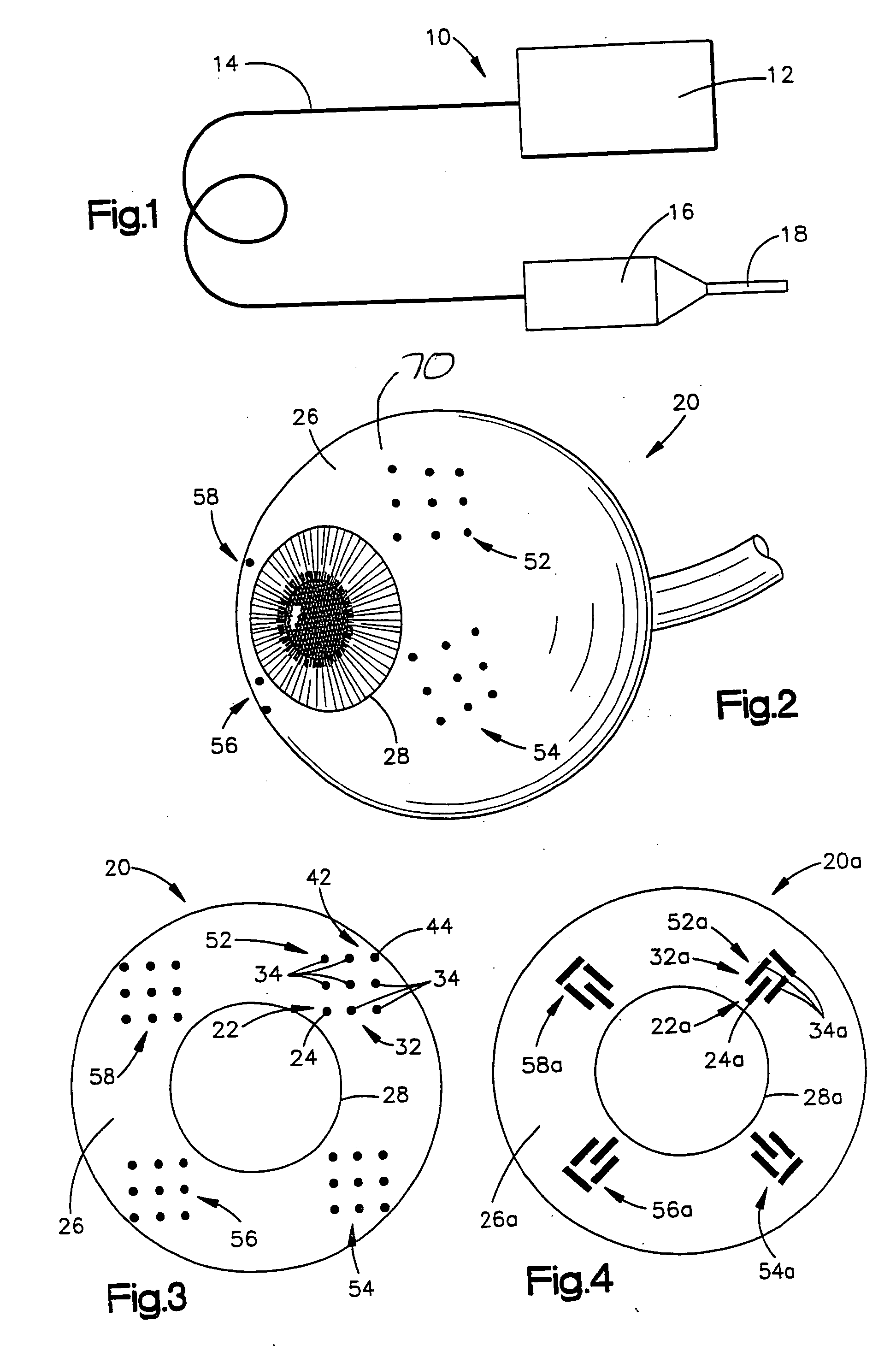 System and method for treating connective tissue