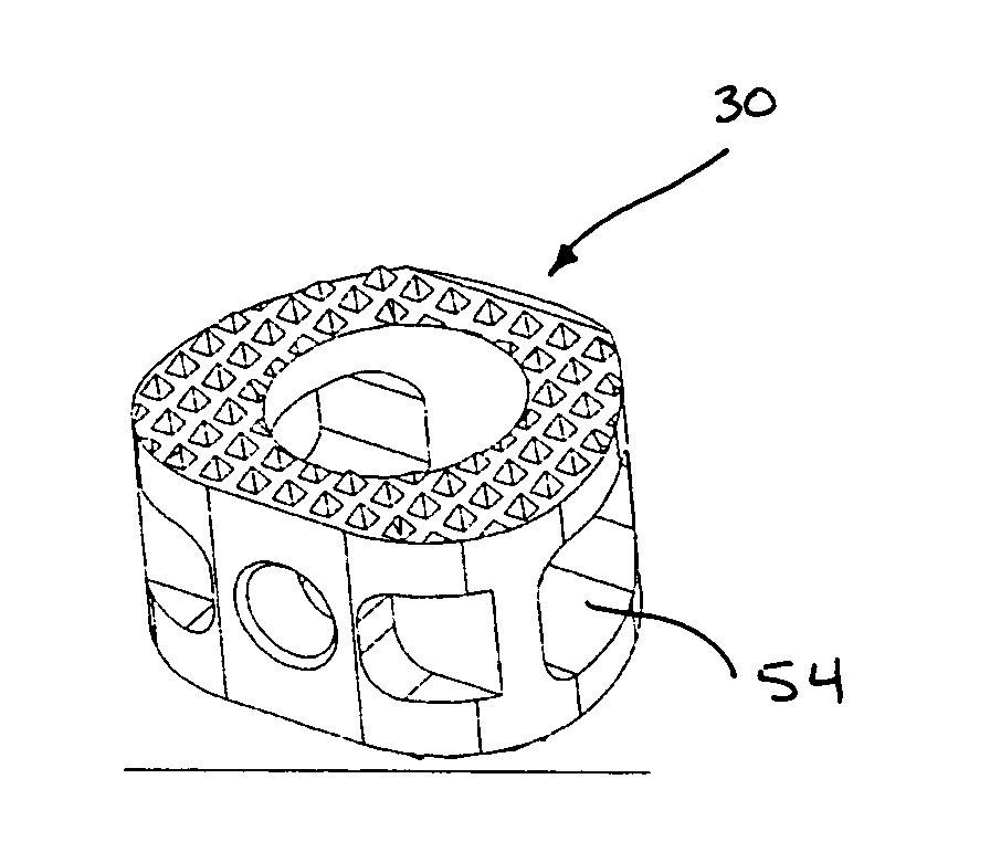 Spinal fusion implant