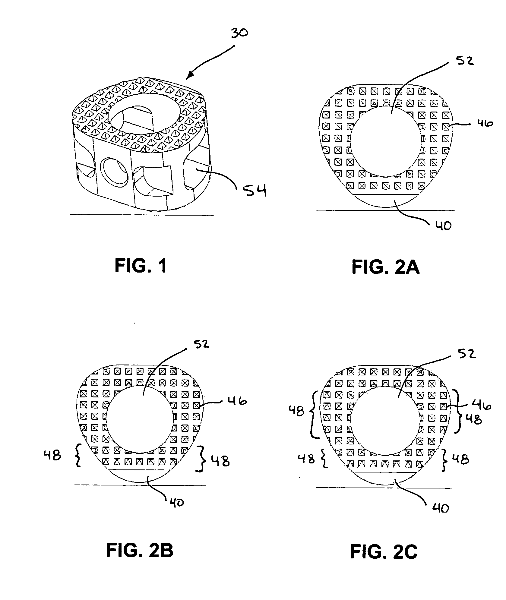 Spinal fusion implant