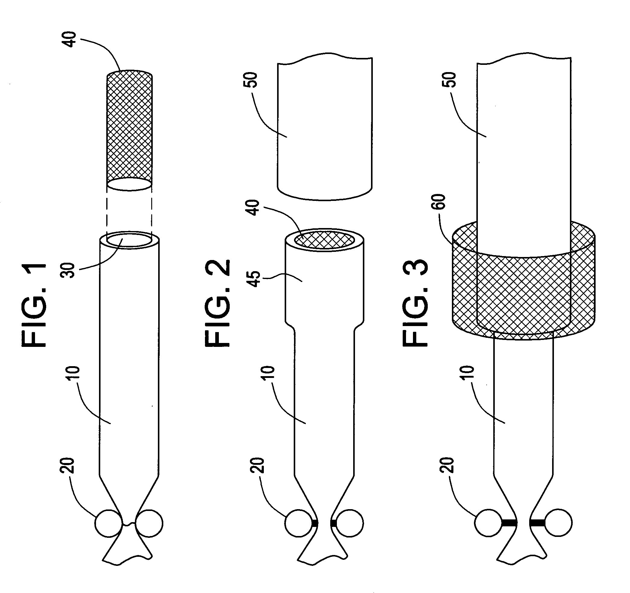 Method and system of attaching vessels to grafts