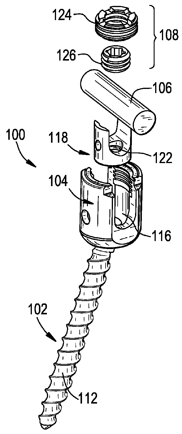 Multipoint fixation implants