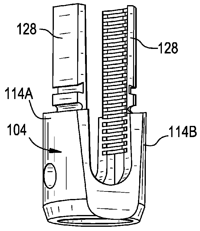 Multipoint fixation implants