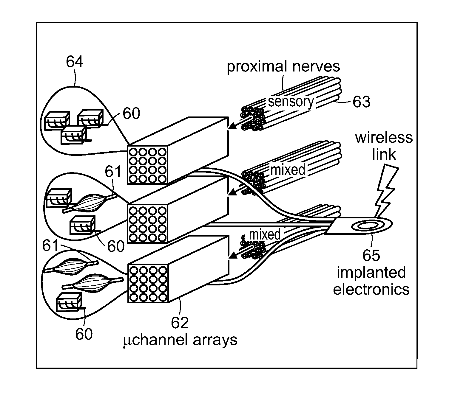 Peripheral neural interface via nerve regeneration to distal tissues