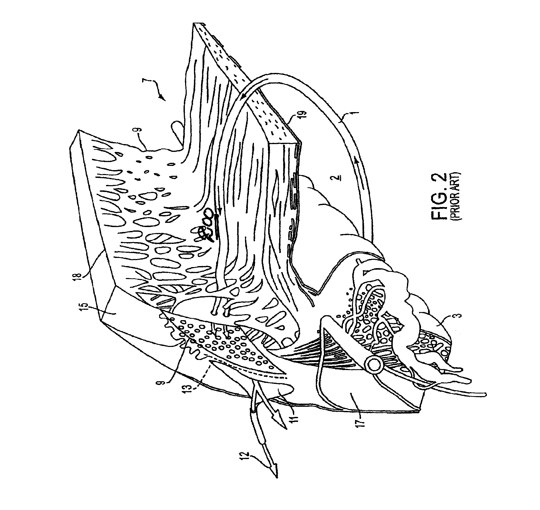 Delivery system and method of use for the eye