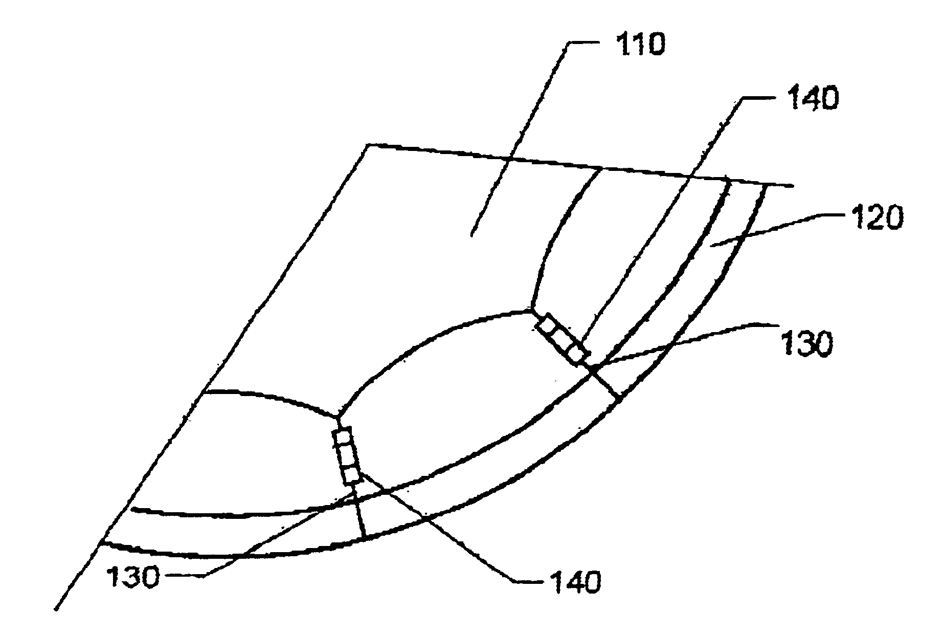 Membrane tension control