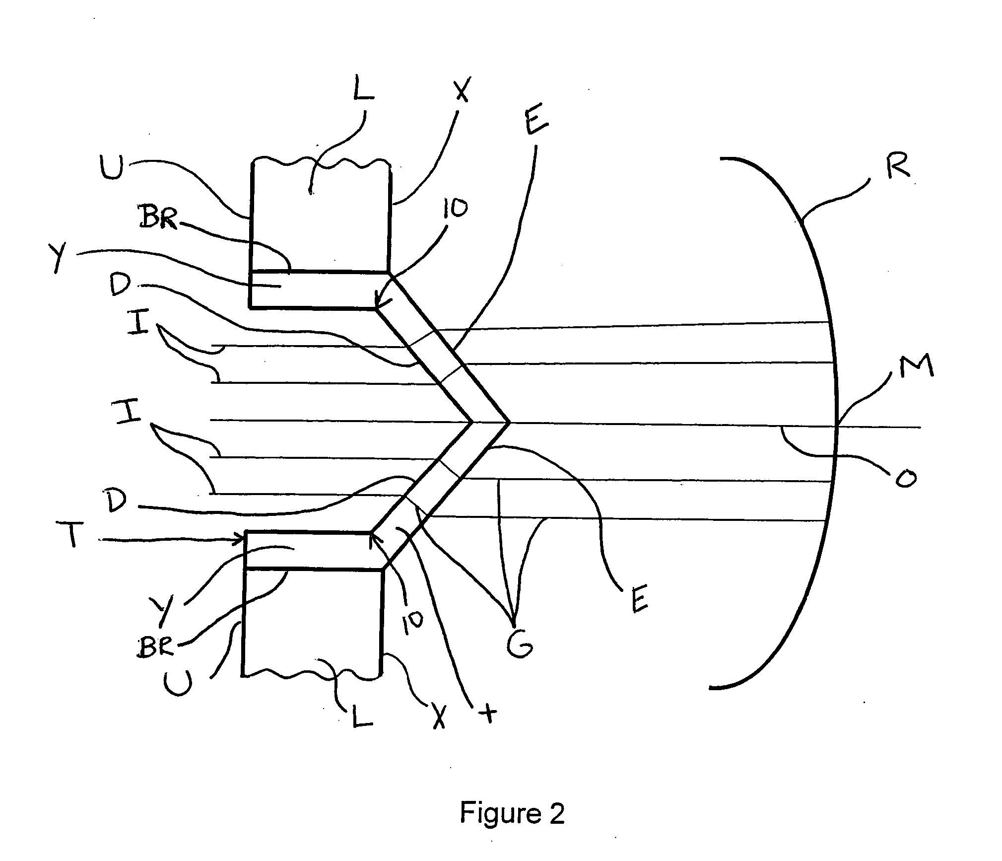 Vision enhancing device