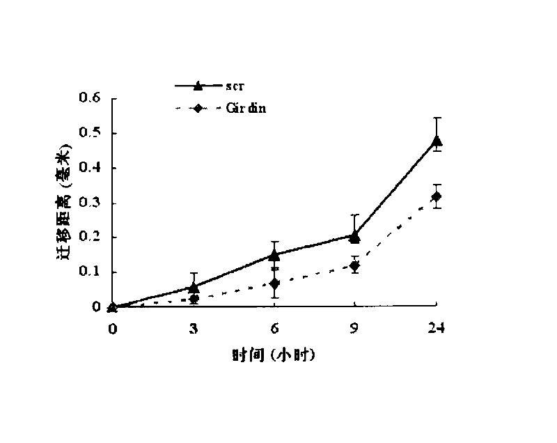 Cytoskeletal binding protein siRNA (small interfering ribonucleic acid) interfering sequence, fusion expression vector thereof and medical application of same