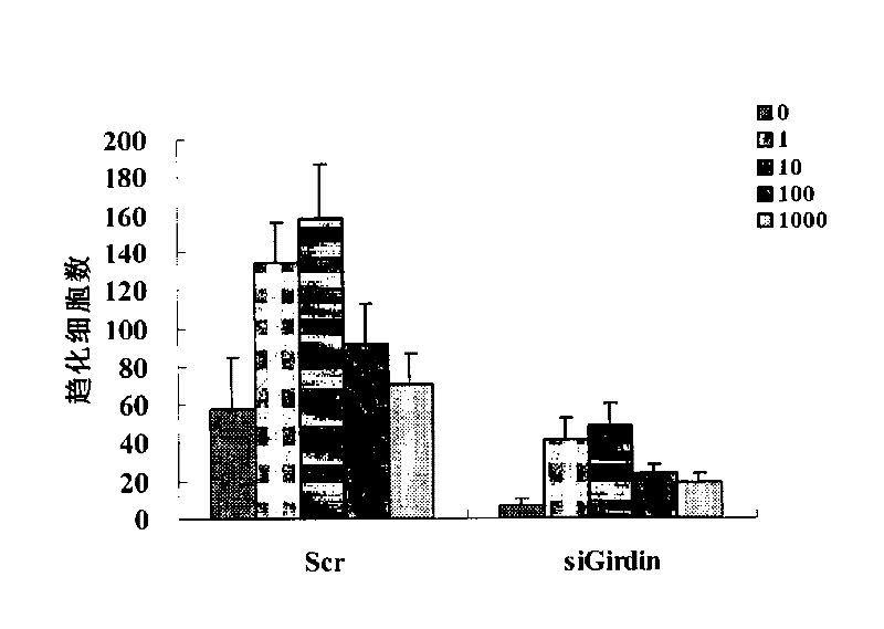 Cytoskeletal binding protein siRNA (small interfering ribonucleic acid) interfering sequence, fusion expression vector thereof and medical application of same