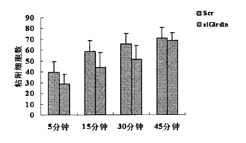 Cytoskeletal binding protein siRNA (small interfering ribonucleic acid) interfering sequence, fusion expression vector thereof and medical application of same