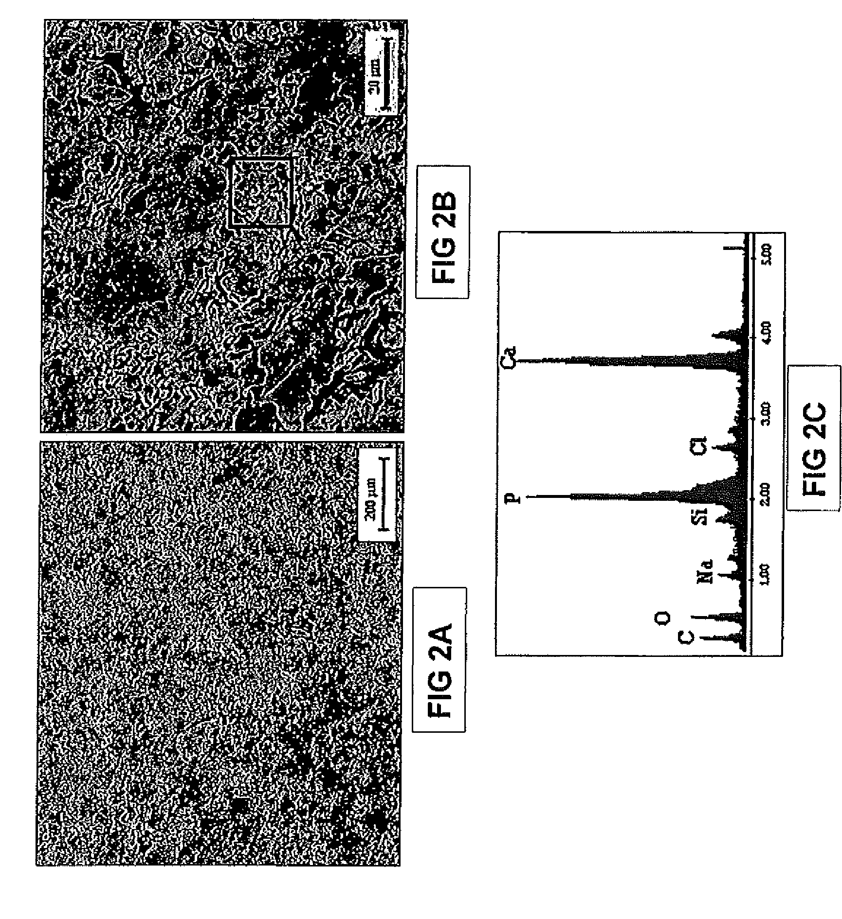 Bioactive Load-Bearing Composites