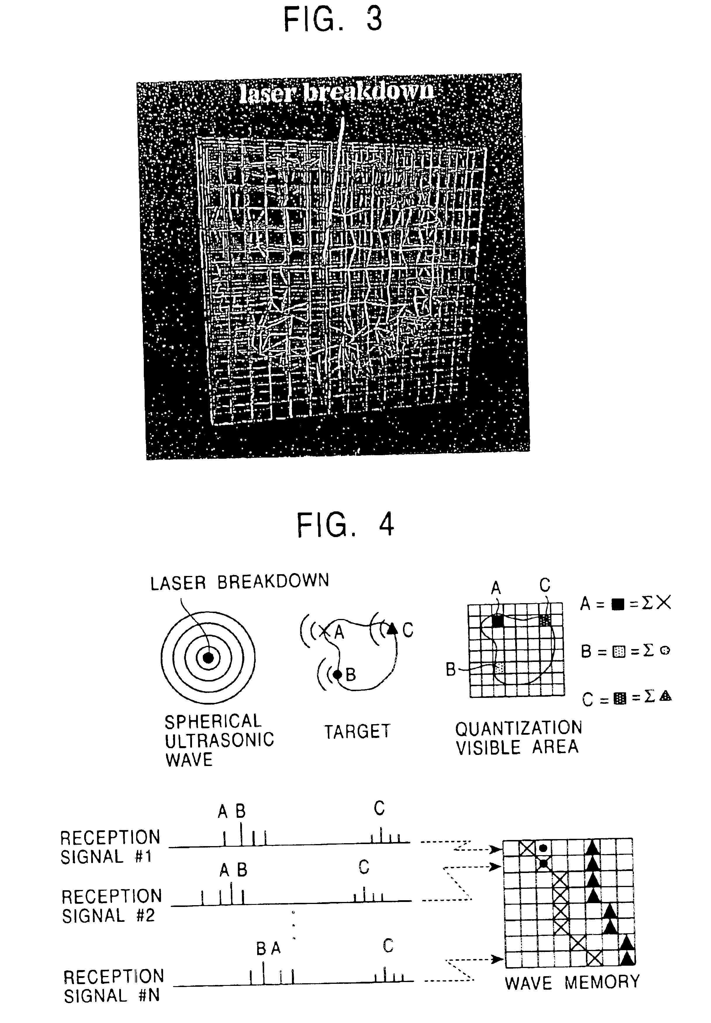 Ultrasonic angioscope system