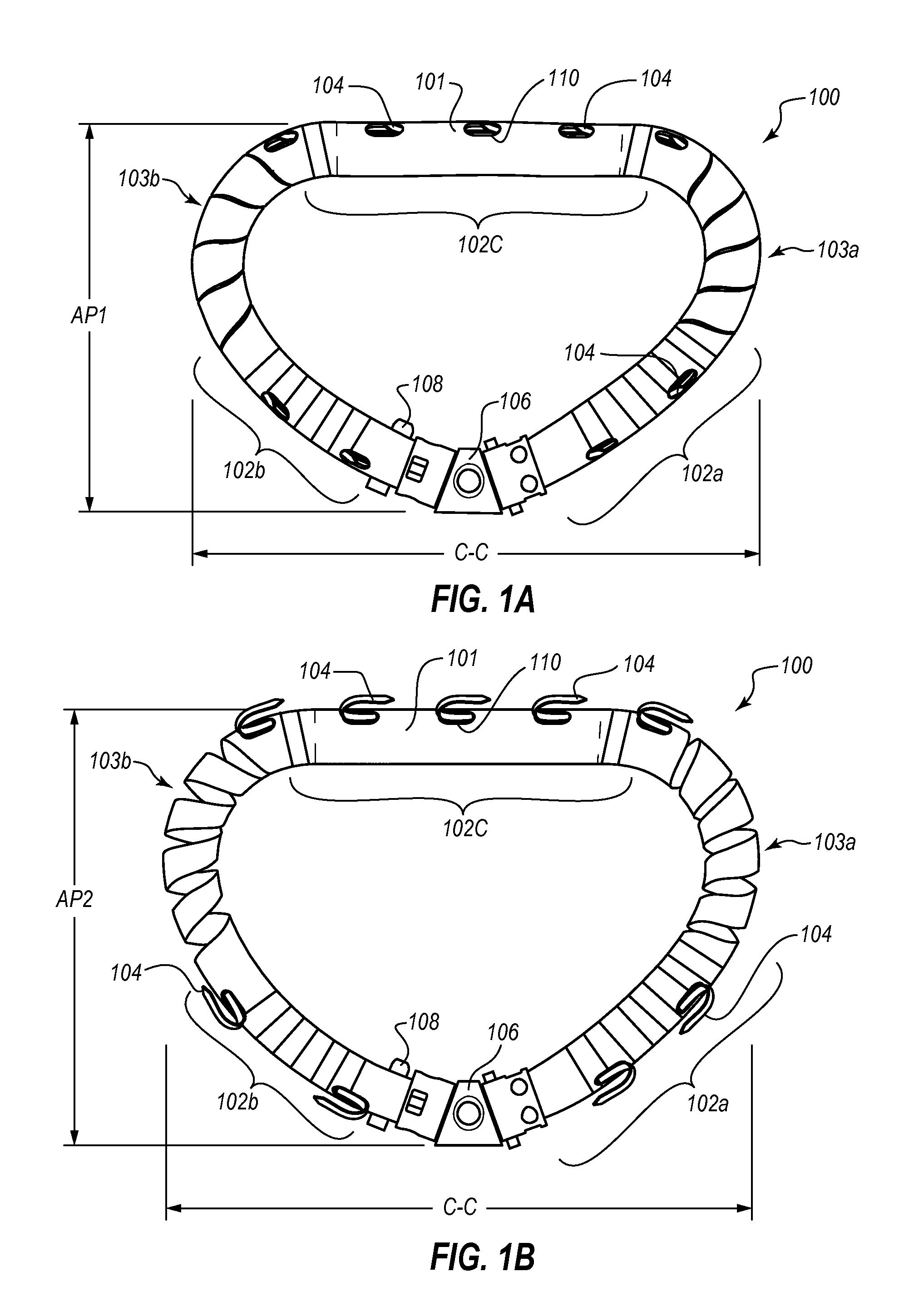 Percutaneous annuloplasty system with anterior-posterior adjustment