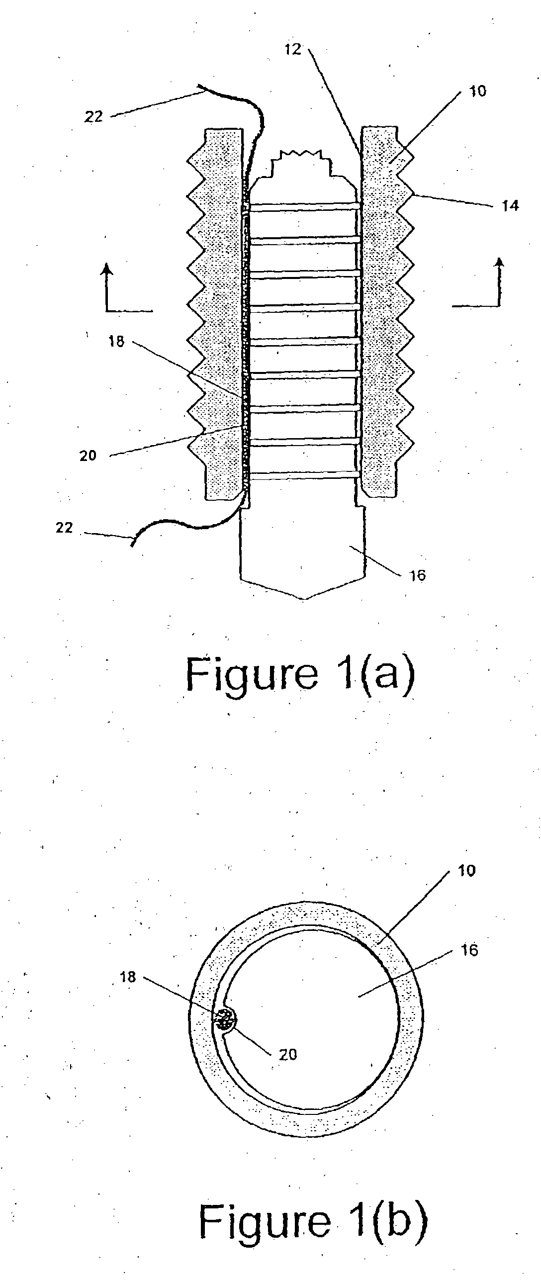 Self-locking suture anchor