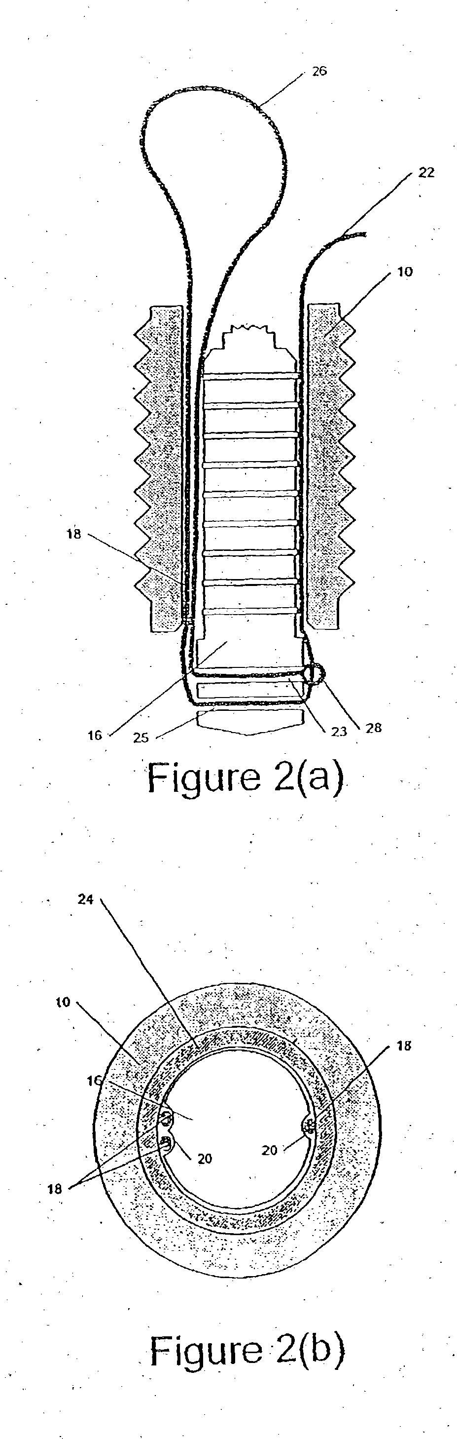 Self-locking suture anchor