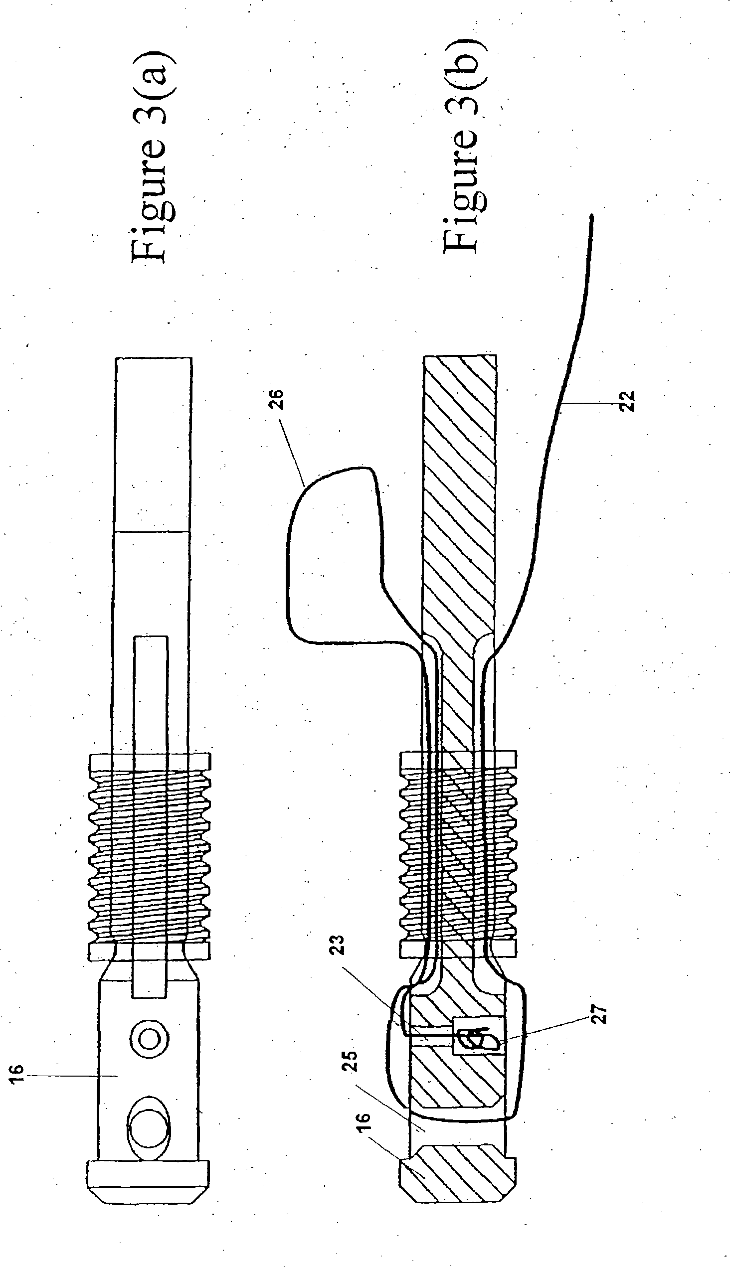 Self-locking suture anchor