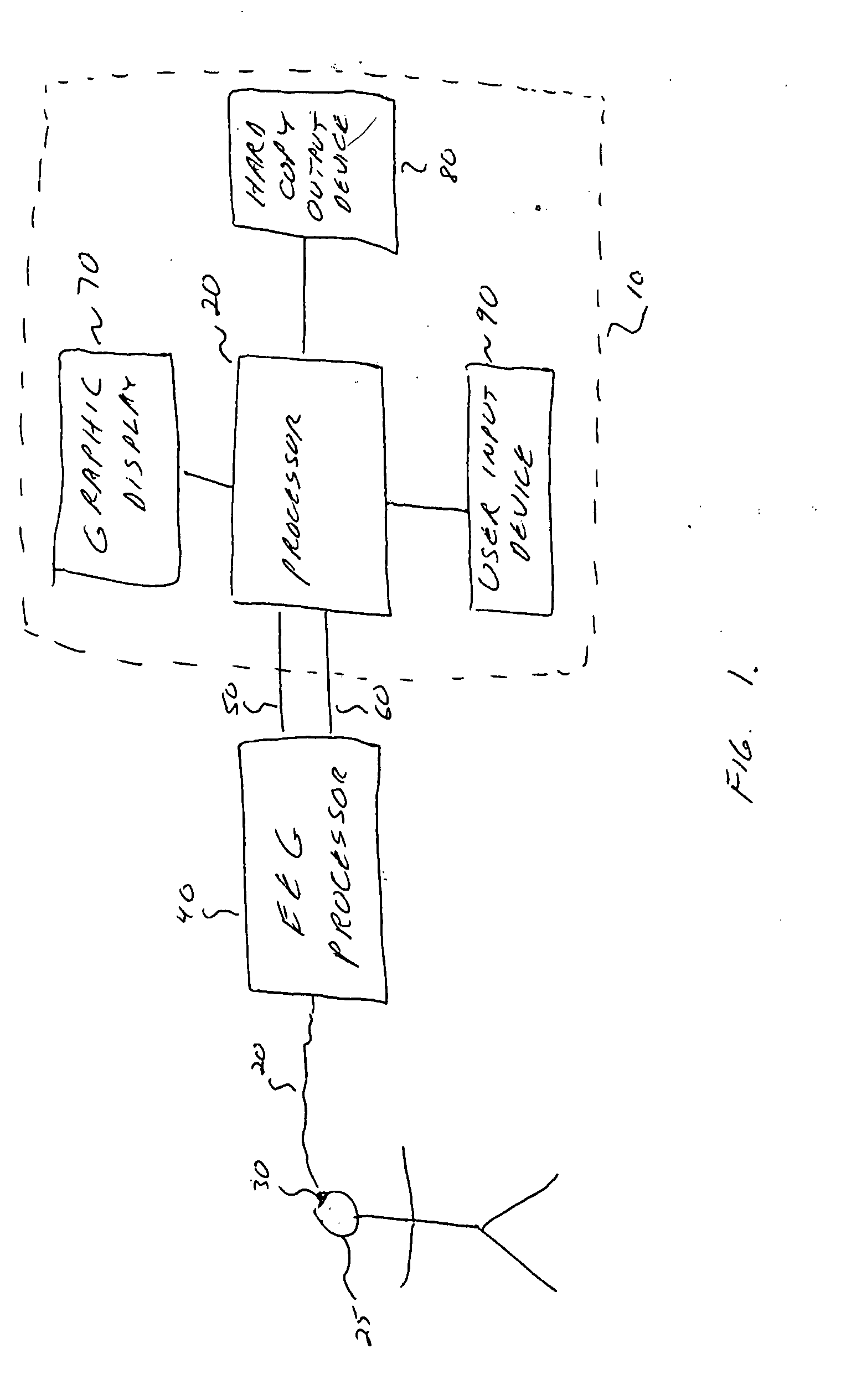 System and method of assessing analgesic adequacy using biopotential variability