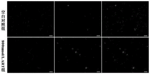 Application of artesunate in preparing medicine for treating and preventing central nerve injury