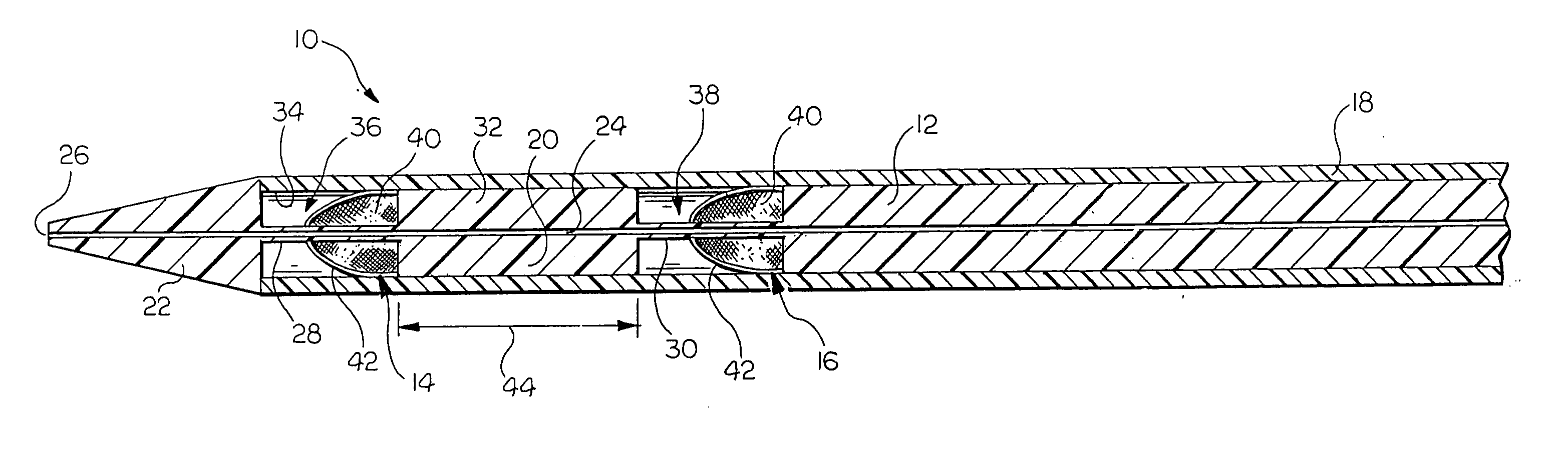 Placement of multiple intraluminal medical devices within a body vessel