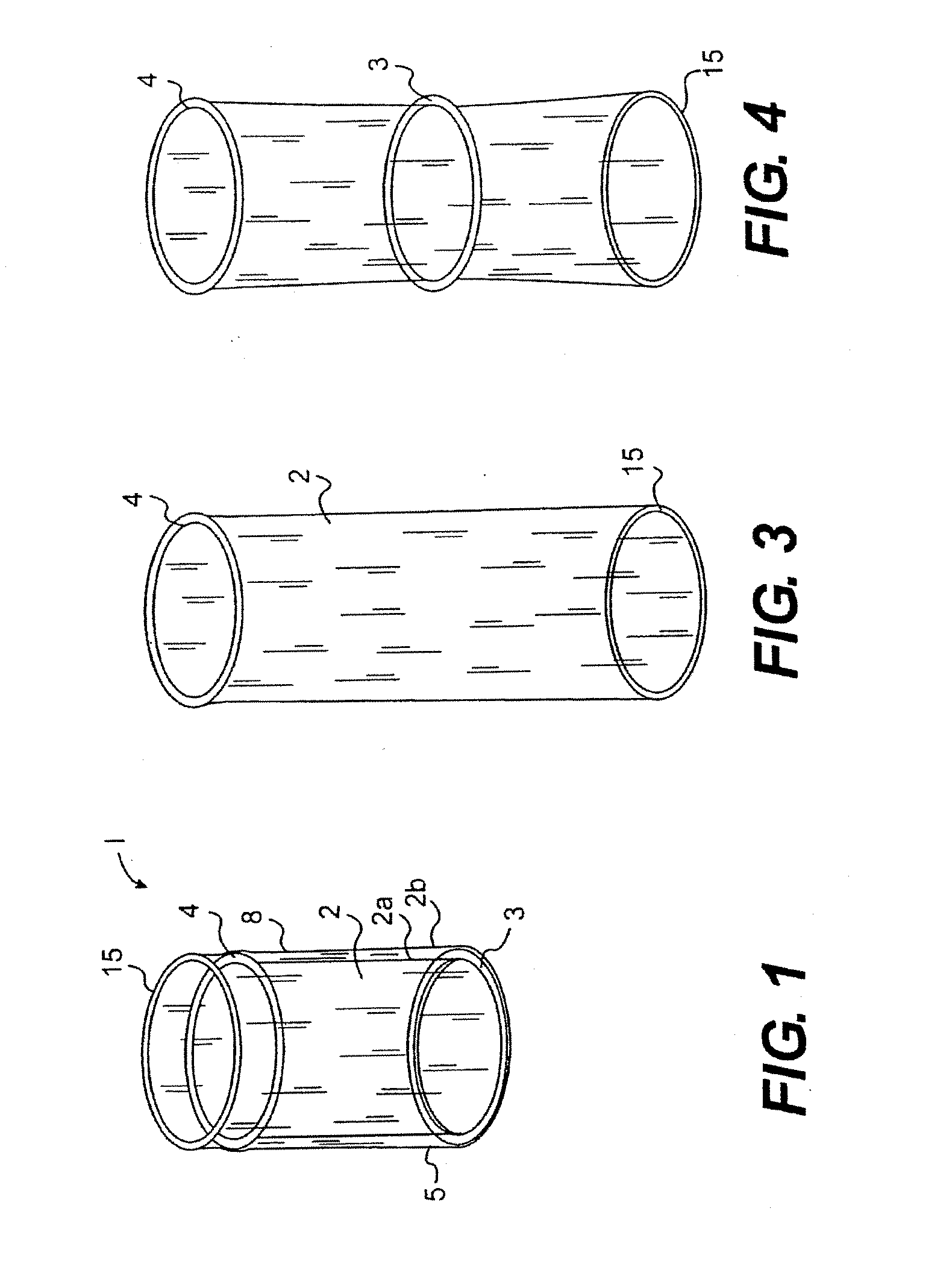 Wound retractor device