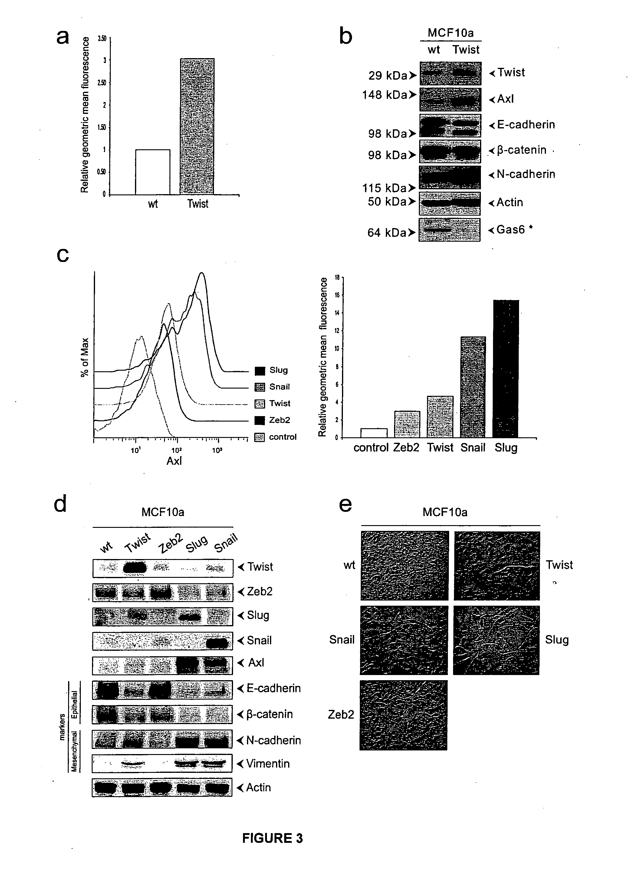 Methods using axl as a biomarker of epithelial-to-mesenchymal transition