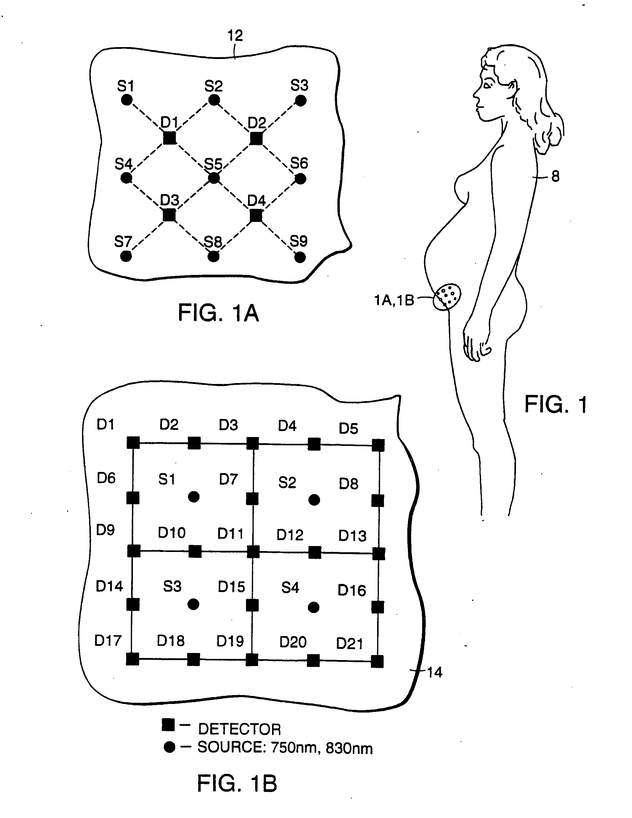 Transabdominal examination, monitoring and imaging of tissue