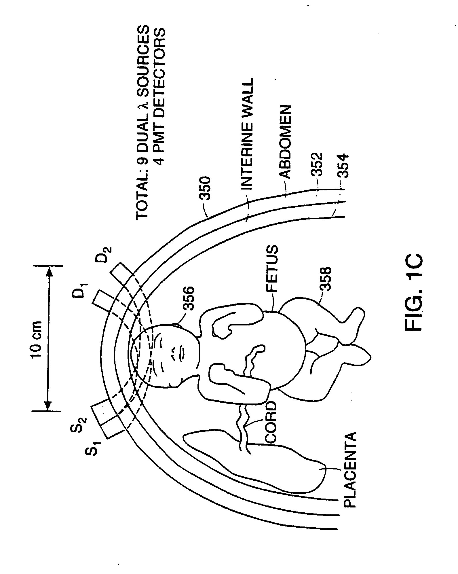 Transabdominal examination, monitoring and imaging of tissue