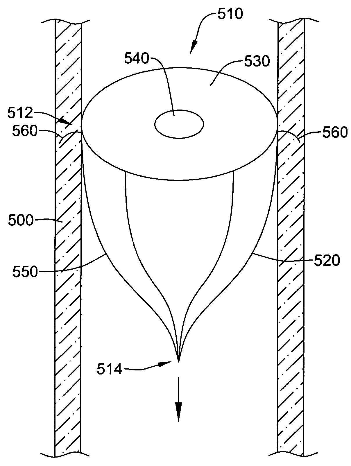 Diversion device to increase cerebral blood flow