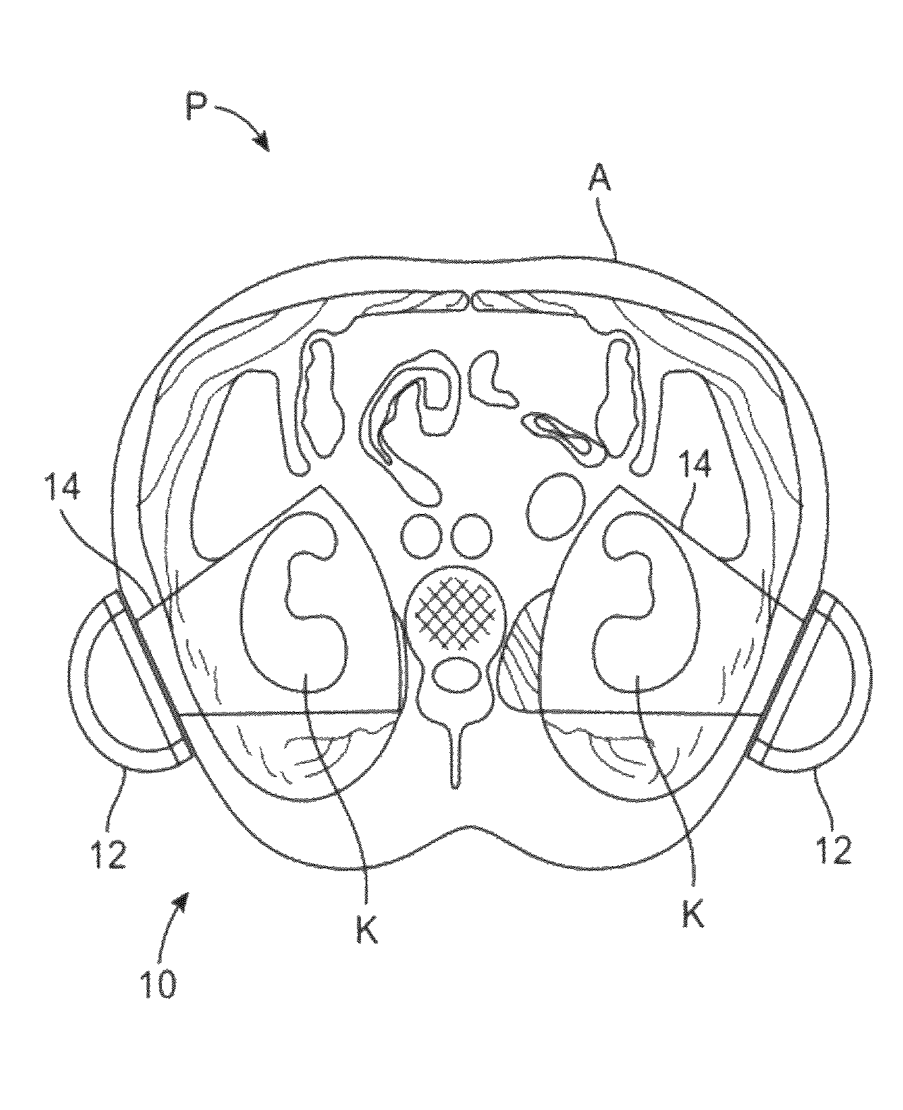 Macro/micro duty cycle devices, systems, and methods employing low-frequency ultrasound or other cyclical pressure energies