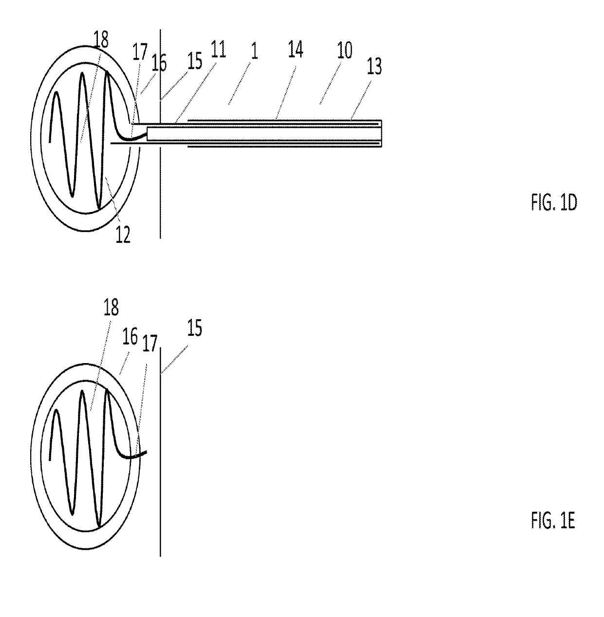 Systems and methods for implant delivery