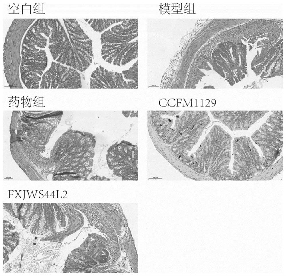 Application of lactobacillus rhamnosus to preventing and relieving ulcerative colitis